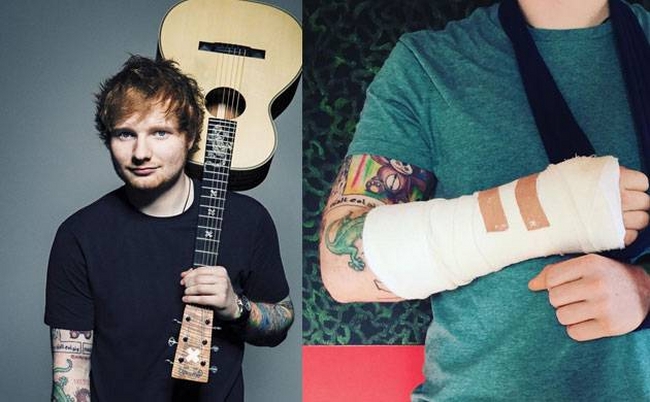 Ed Sheeran Gets in Bicycle Accident which might cause him to Postpone his Tour
